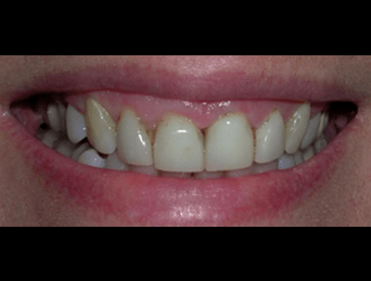 Before - Woods Dental