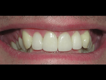After - Woods Dental