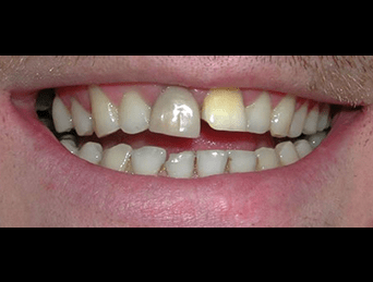 Before - Woods Dental